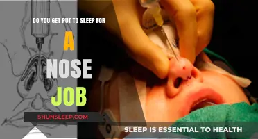 Nose Job Anesthesia: Understanding Sedation Options for Rhinoplasty Surgery