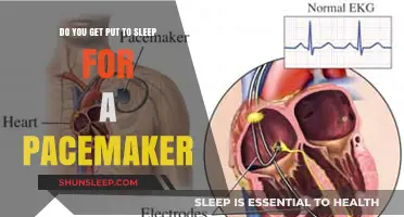 Pacemaker Surgery: Understanding Anesthesia and the Procedure Process