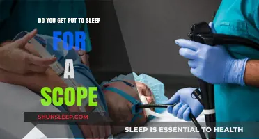Do You Get Put to Sleep for a Scope? Understanding Sedation in Endoscopy