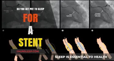 Stent Procedure Anesthesia: Understanding Sedation During Stent Placement