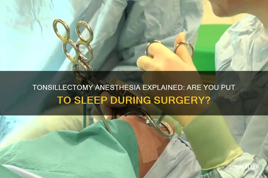 do you get put to sleep for a tonsillectomy