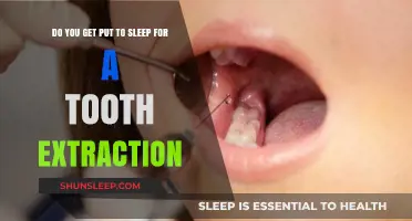Tooth Extraction Anesthesia: Do You Need to Be Put to Sleep?