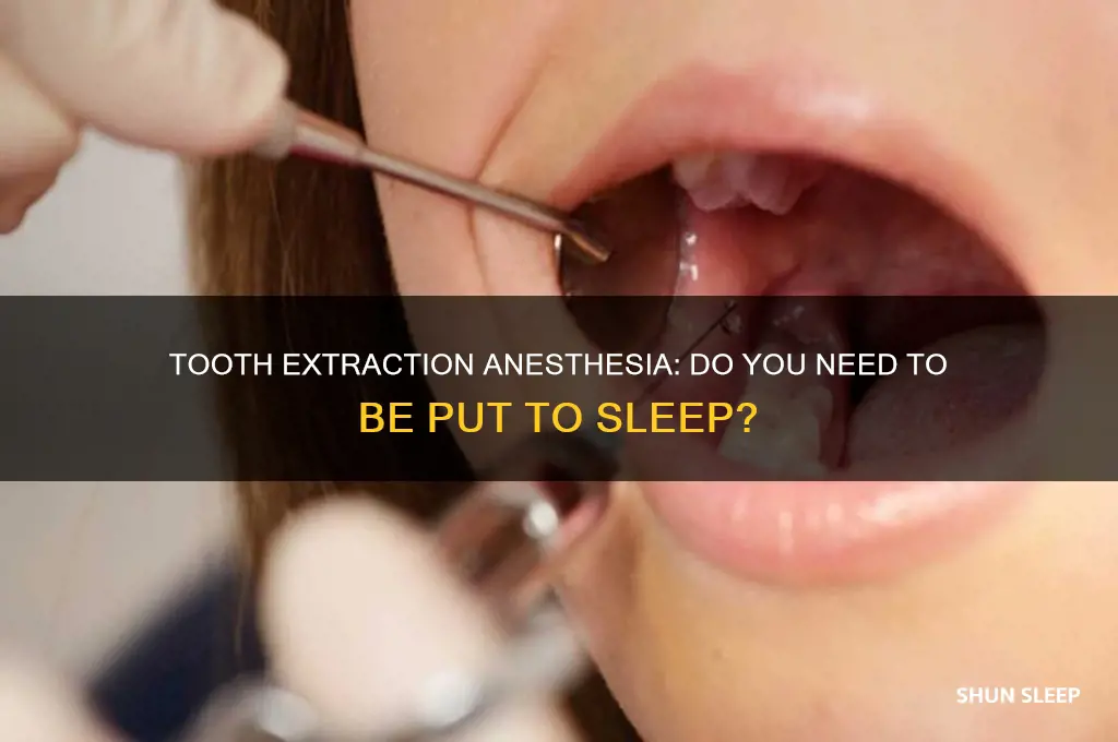 do you get put to sleep for a tooth extraction