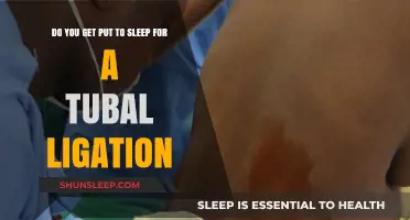 Tubal Ligation Anesthesia: Understanding Sedation During the Procedure
