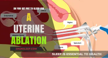 Uterine Ablation Procedure: Understanding Anesthesia and What to Expect