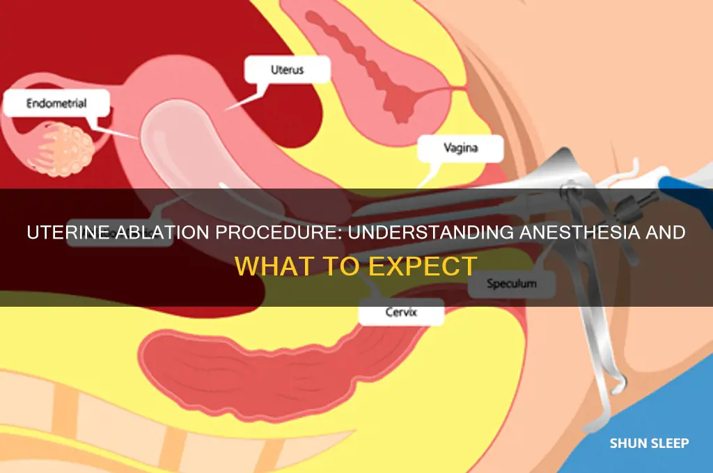 do you get put to sleep for a uterine ablation