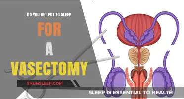 Vasectomy Procedure Explained: Are You Put to Sleep During the Surgery?