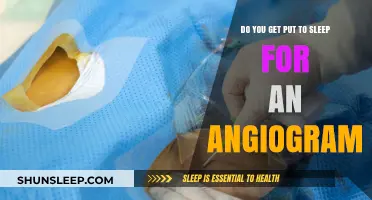 Angiogram Procedure Explained: Understanding Sedation and What to Expect