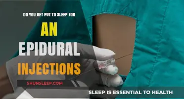 Epidural Injections: Understanding Sedation and Anesthesia During the Procedure