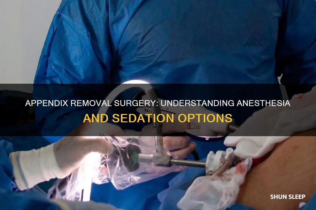 do you get put to sleep for appendix removal