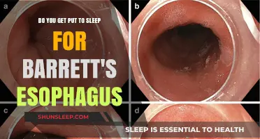 Understanding Barrett's Esophagus: Anesthesia Requirements Explained Simply