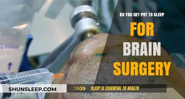 Brain Surgery Anesthesia: Understanding Sedation During Neurological Procedures