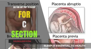 C-Section Anesthesia Explained: What to Expect During Your Procedure