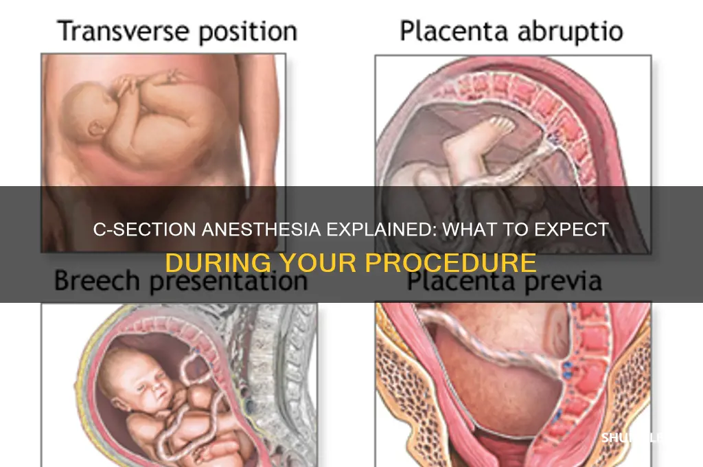 do you get put to sleep for c section