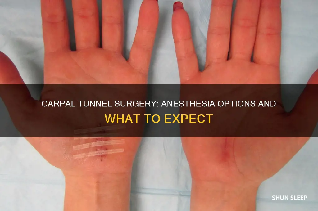 do you get put to sleep for carpal tunnel surgery
