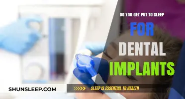 Dental Implants and Anesthesia: What to Expect During the Procedure