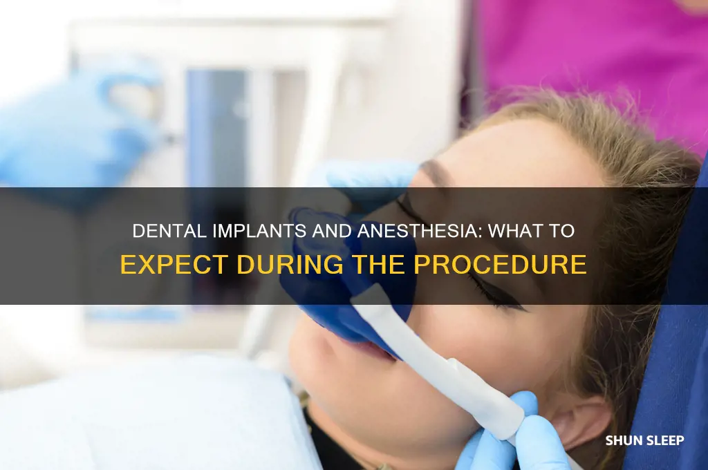 do you get put to sleep for dental implants
