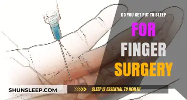 Finger Surgery Anesthesia: What to Expect During Your Procedure
