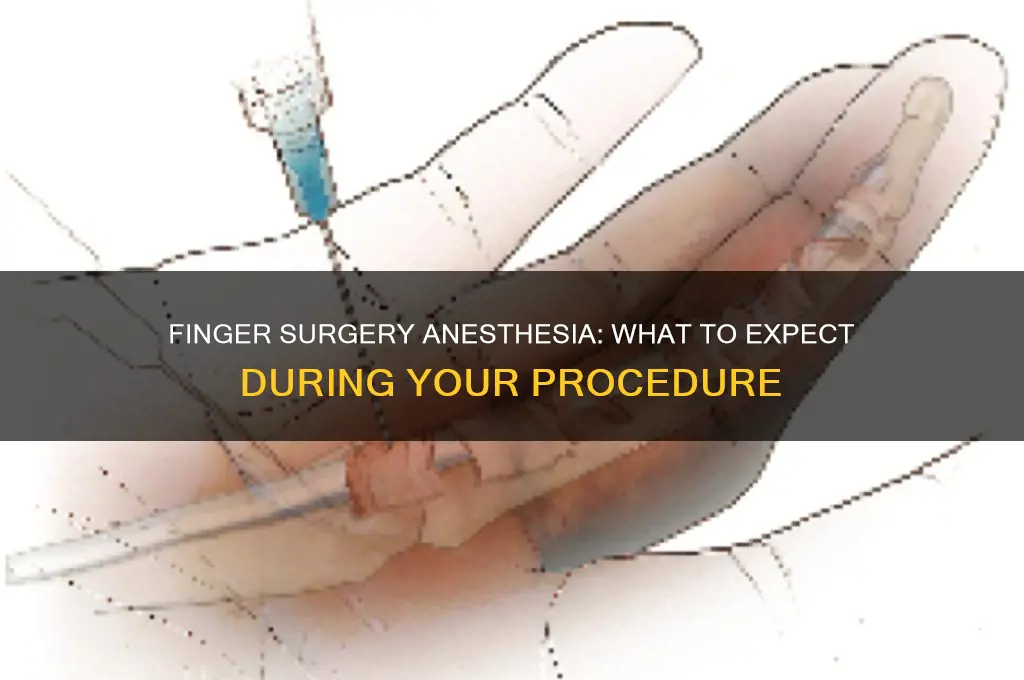 do you get put to sleep for finger surgery