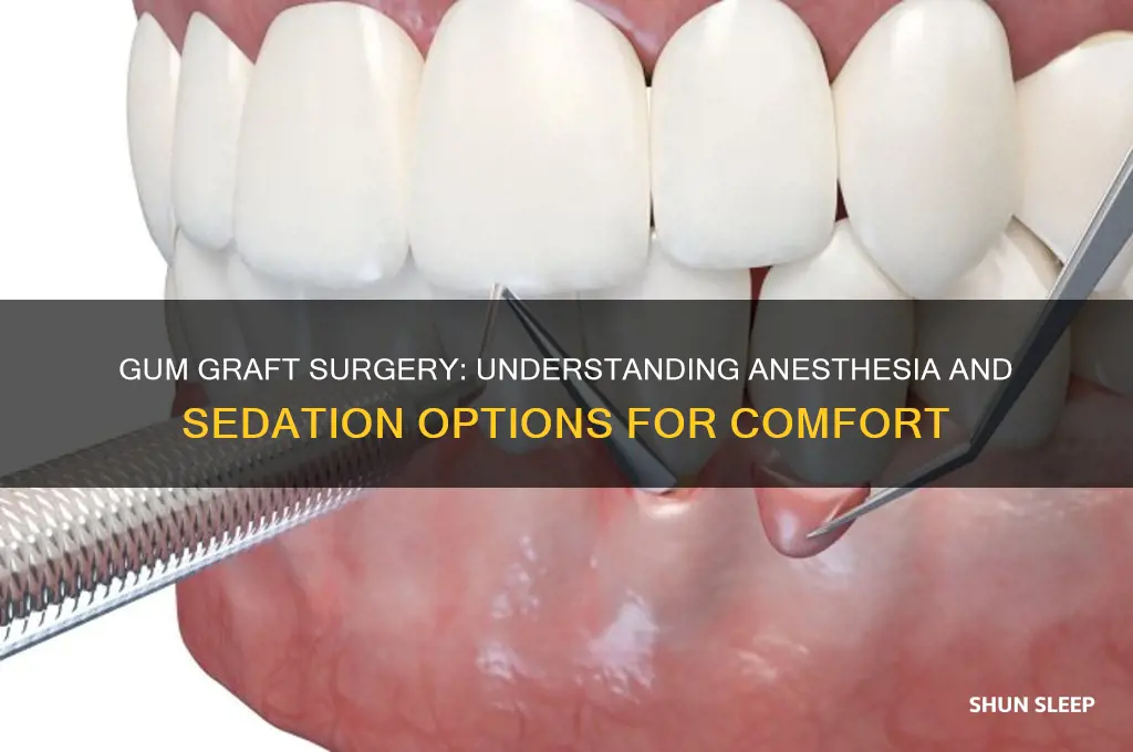 do you get put to sleep for gum graft