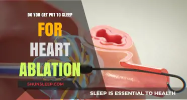 Heart Ablation Procedure: Understanding Anesthesia and Sedation Options