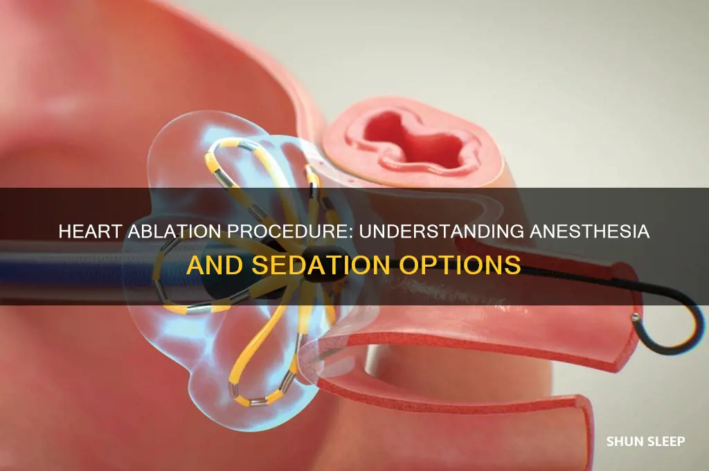 do you get put to sleep for heart ablation