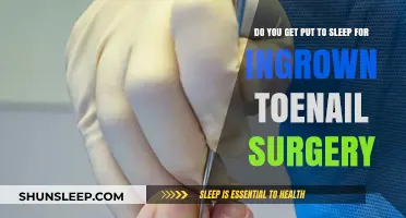 Ingrown Toenail Surgery: Anesthesia Explained – What to Expect