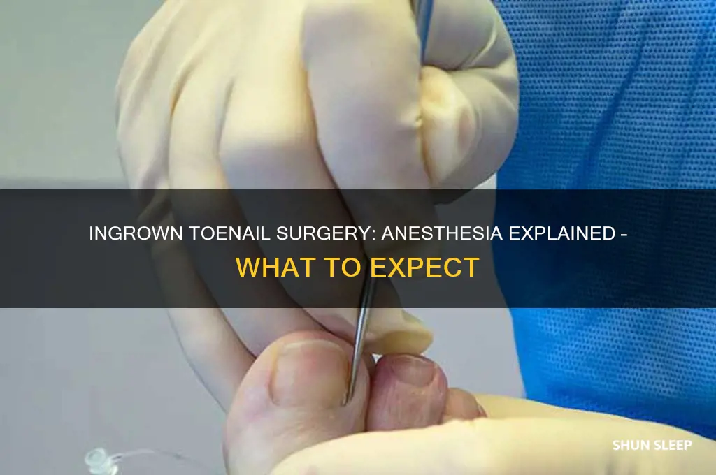 do you get put to sleep for ingrown toenail surgery