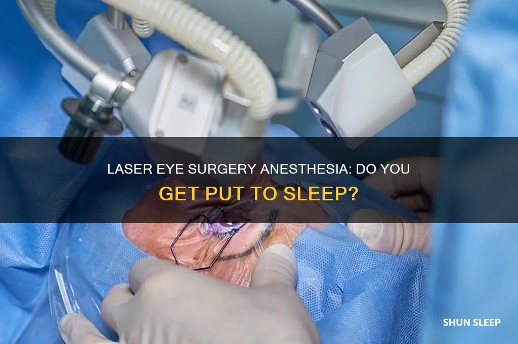 do you get put to sleep for laser eye surgery
