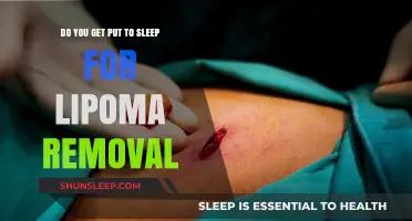Lipoma Removal Surgery: Anesthesia and What to Expect During the Procedure
