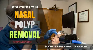 Nasal Polyp Removal: Understanding Anesthesia Options for a Comfortable Procedure
