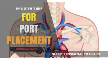 Port Placement Procedure: Understanding Anesthesia and Sedation Options