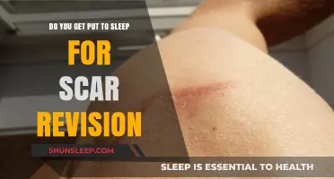 Scar Revision Surgery: Understanding Anesthesia and Sedation Options for Comfort