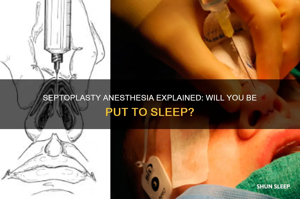 do you get put to sleep for septoplasty