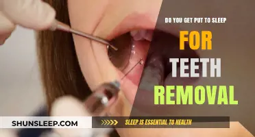 Do You Need Anesthesia for Tooth Extraction? What to Expect
