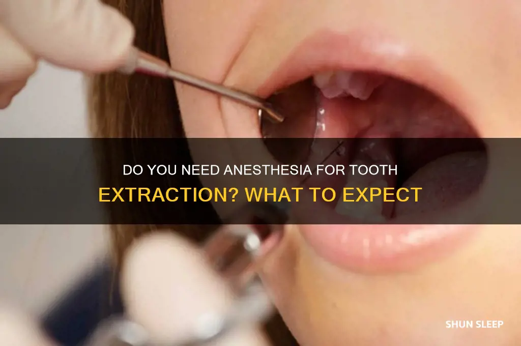 do you get put to sleep for teeth removal