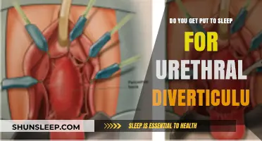 Urethral Diverticulum Surgery: Understanding Anesthesia and Procedure Details