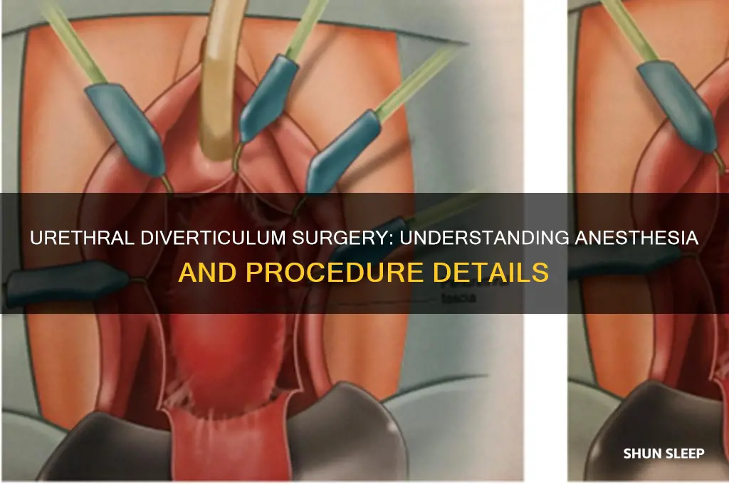 do you get put to sleep for urethral diverticulum