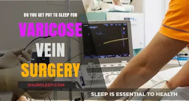 Varicose Vein Surgery: Understanding Anesthesia and Sedation Options