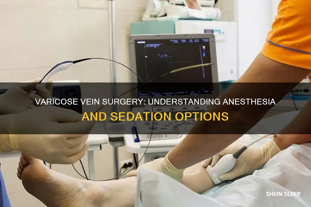 do you get put to sleep for varicose vein surgery