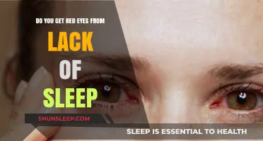 Sleep Deprivation and Red Eyes: Uncovering the Tired Truth