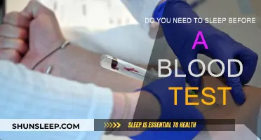 Sleep Before a Blood Test: Necessary or Not?