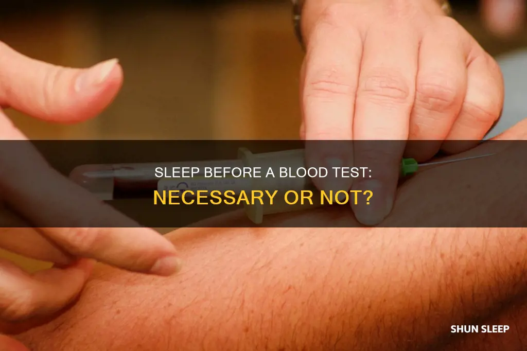 do you need to sleep before a blood test