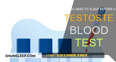 Testosterone Blood Test: Does Sleep Affect the Results?