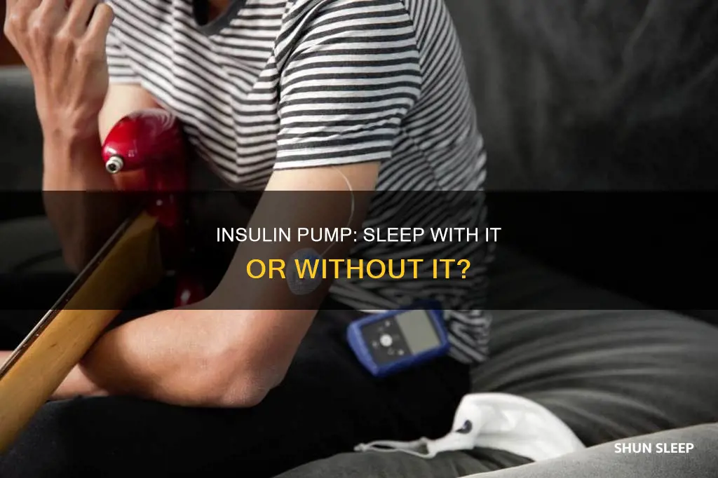 do you need to sleep with an insulin pump