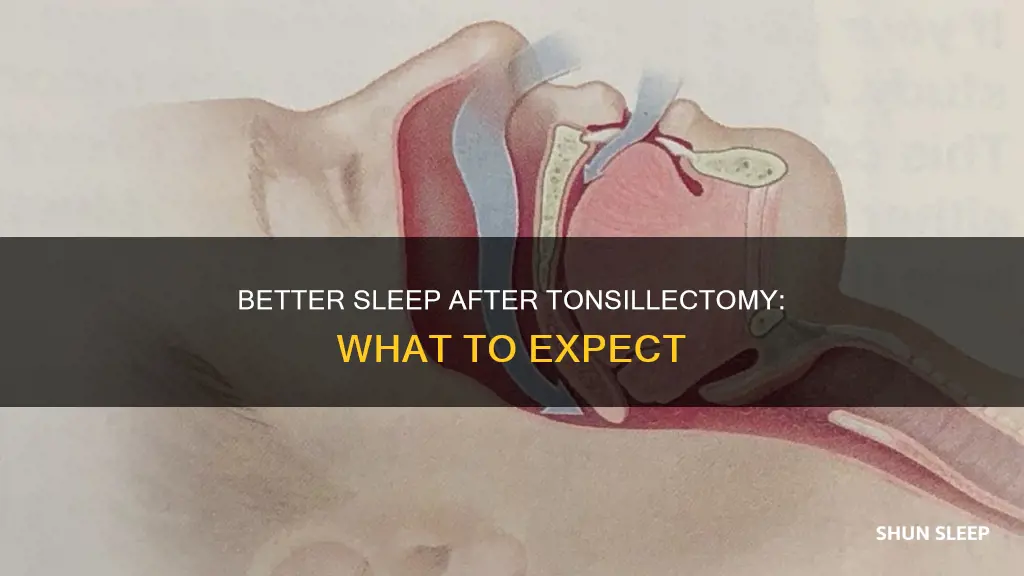 do you sleep better aftet having tonsils removed