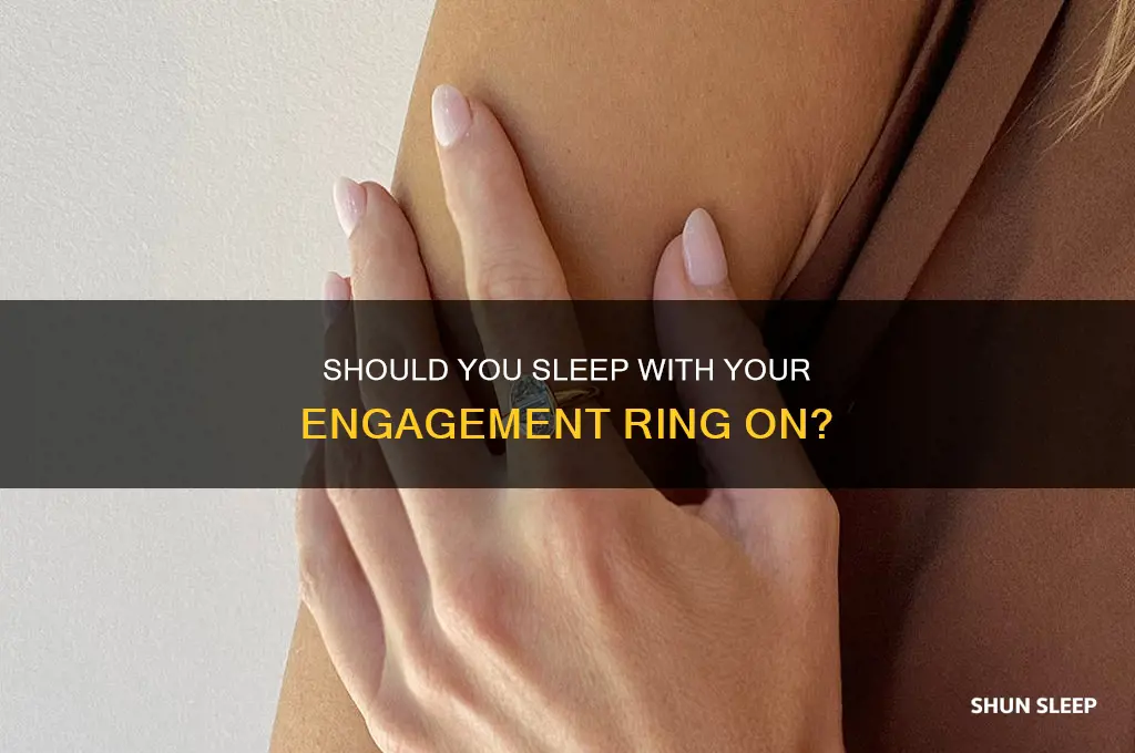 do you take engagement ring off to sleep