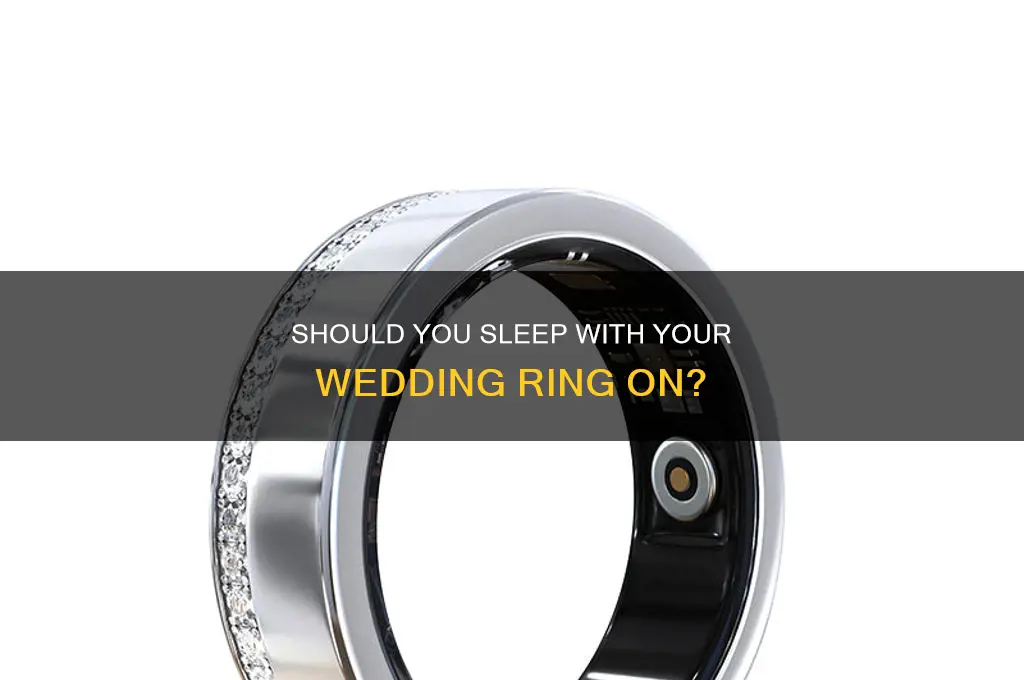 do you take off your wedding ring to sleep