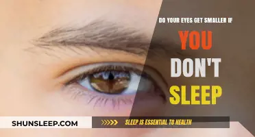 Lack of Sleep: Does It Shrink Your Eyes? Find Out Now