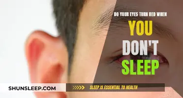 Sleep Deprivation: The Reason Behind Red Eyes